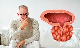 the chronic prostatitis in the stage of